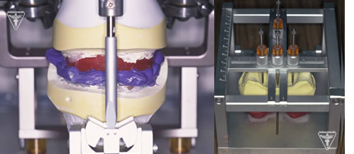 SHILA SYSTEM　入れ歯：写真