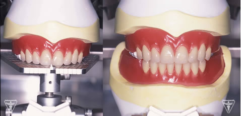 SHIA SYSTEMによりS-Aブレードティース　治療用義歯（入れ歯）
